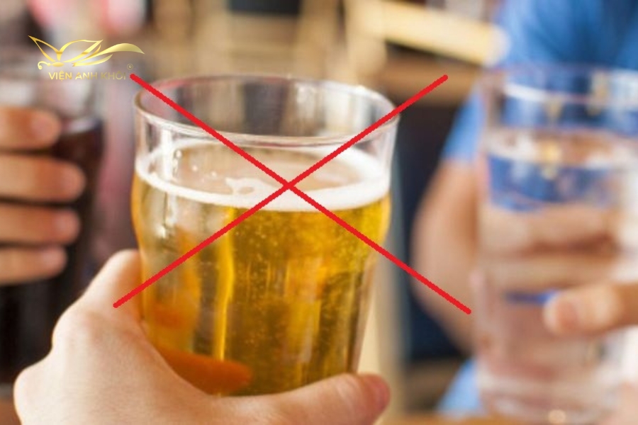 Không uống rượu, bia, chất kích thích sau phun môi