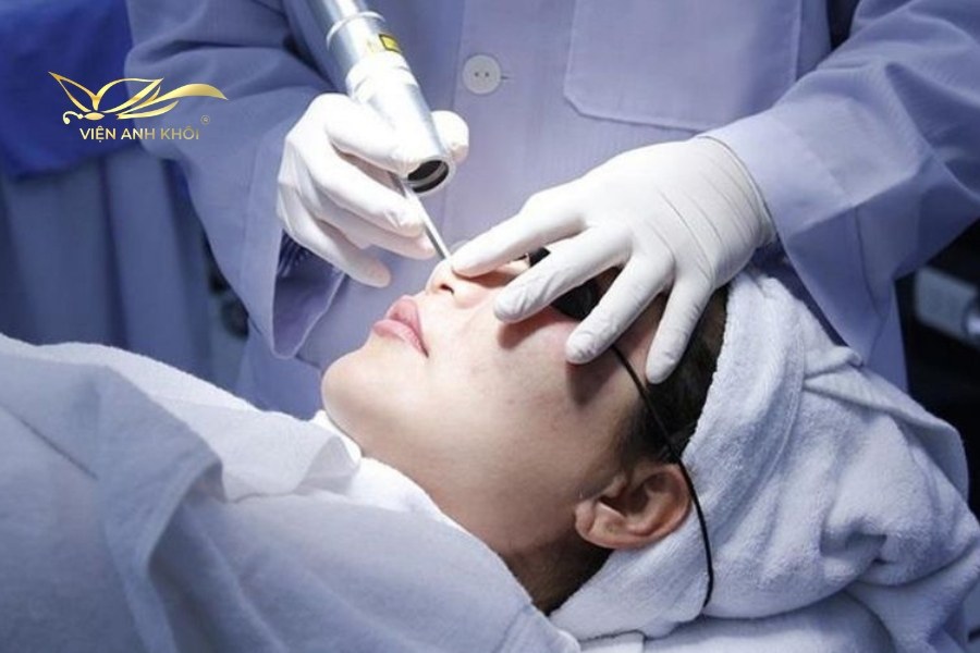 Điều trị sẹo rỗ bằng công nghệ Laser Fractional CO2 là một phương pháp hiện đại và không cần phẫu thuật để giảm thiểu sẹo rỗ.