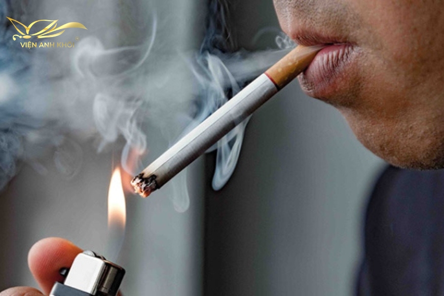 Hút thuốc lá là nguyên nhân chính gây thâm môi ở nam giới