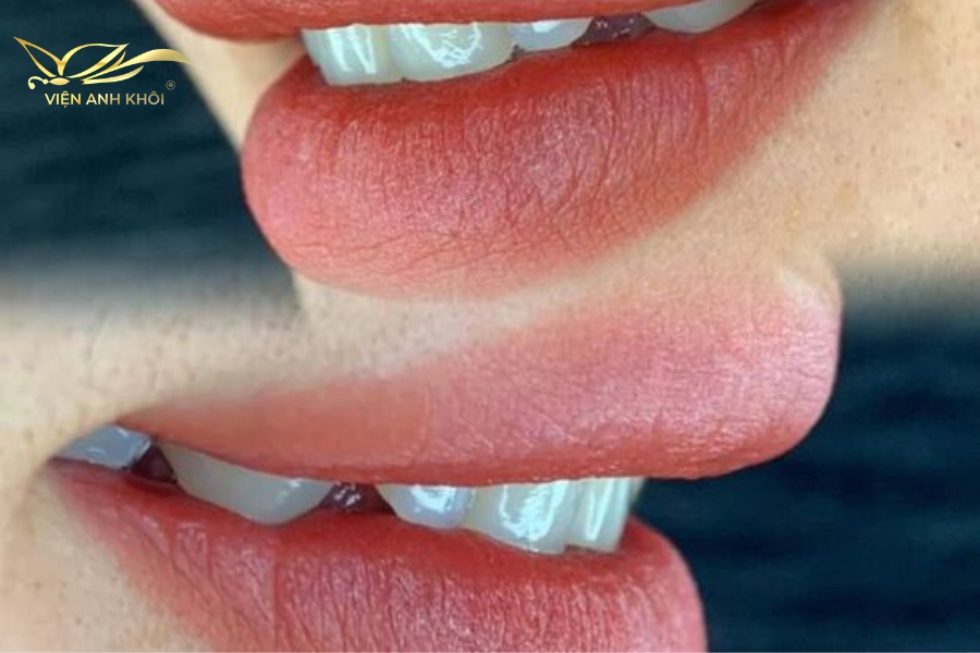 Bạn nên chọn phun màu môi mới gần với màu môi cũ đễ lúc lên màu không bị chênh lệch