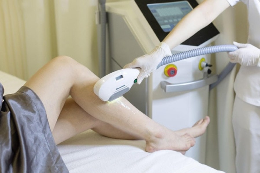 Thời gian của buổi điều trị, cũng như chi phí, thay đổi tùy theo vùng cần điều trị: từ 10 phút, nếu vùng đó nhỏ, đến một giờ nếu tia laser chiếu vào toàn bộ chân.