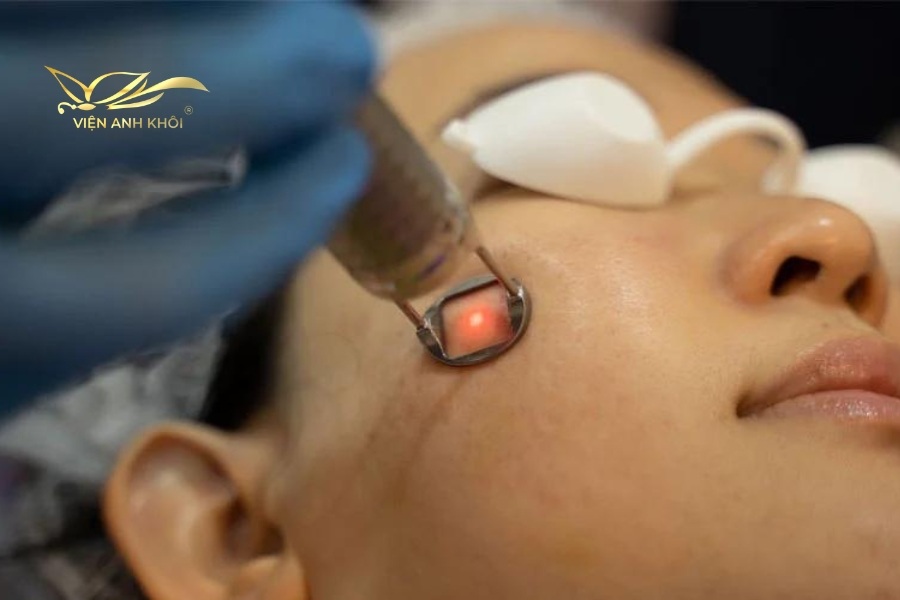 Laser trẻ hóa da là phương pháp được nhiều người ưa chuộng, bởi hiệu quả vượt trội, an toàn, ít xâm lấn.