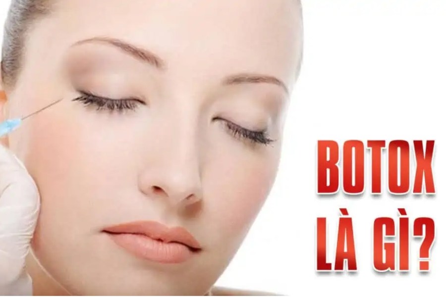 Tiêm botox là phương pháp làm xóa nếp nhăn và thon gon mặt rất được ưa chuộng